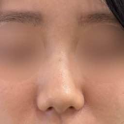 後