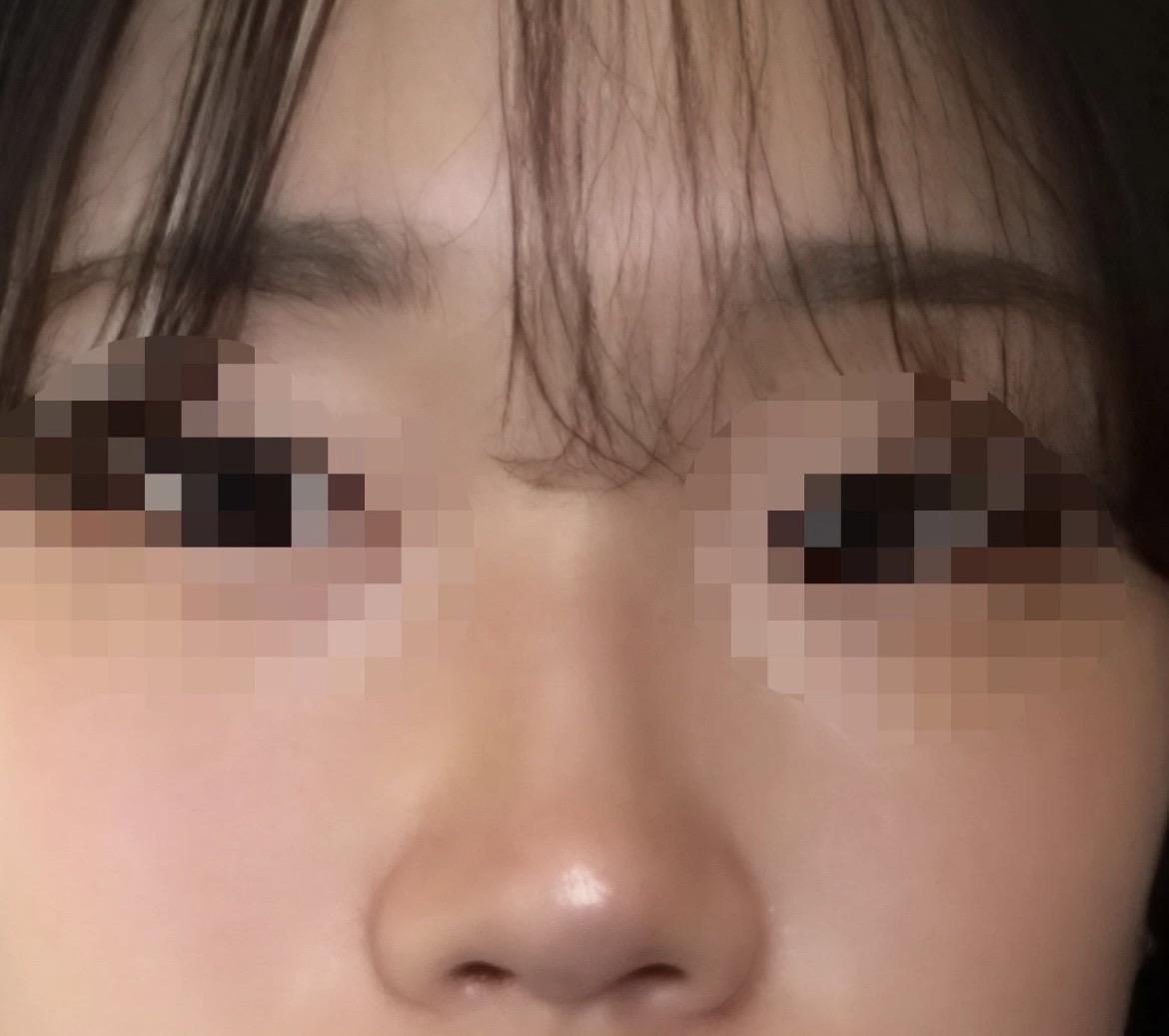 後
