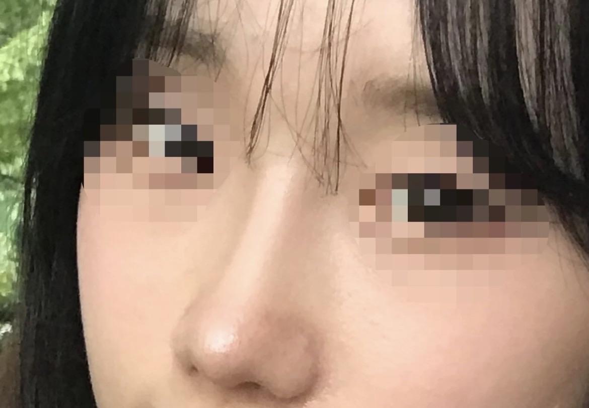 後
