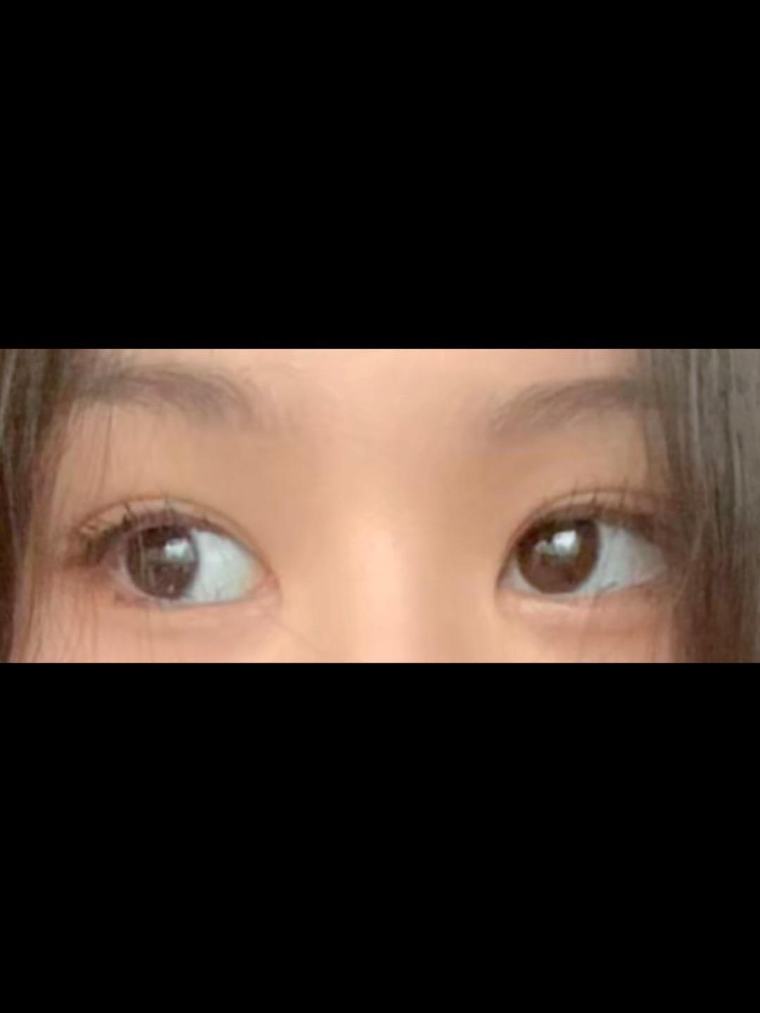 後