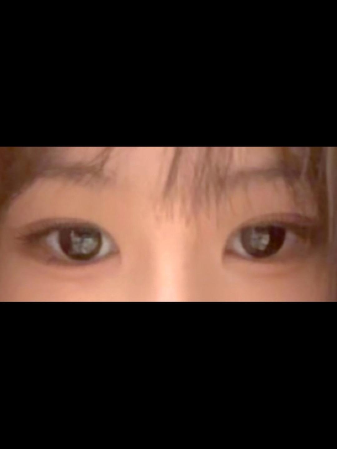 後