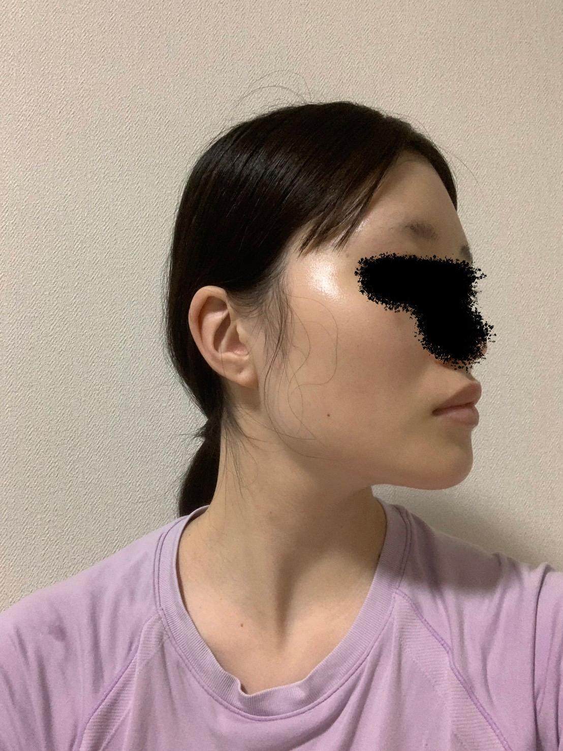 後