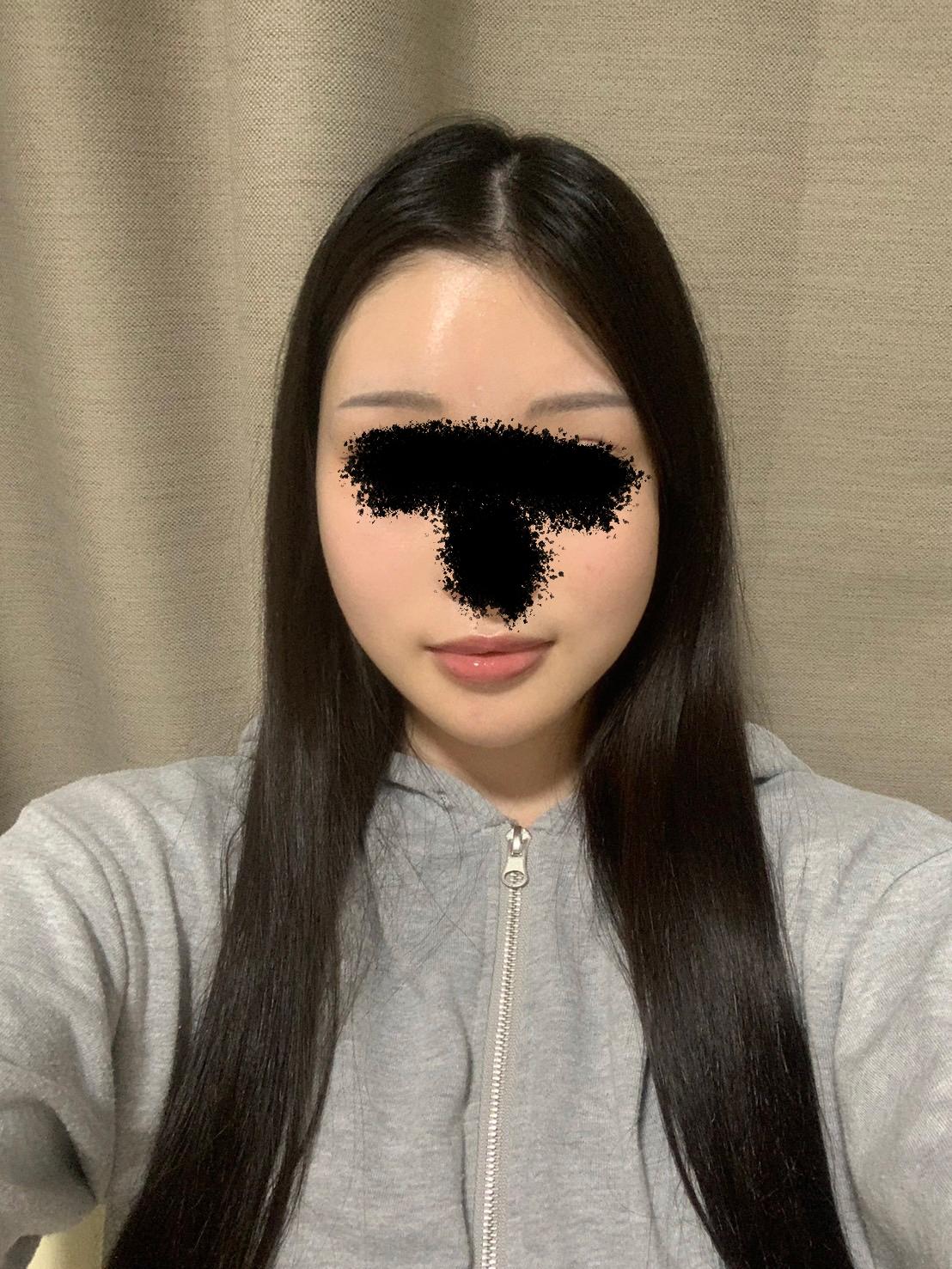 後