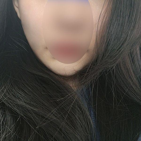 後