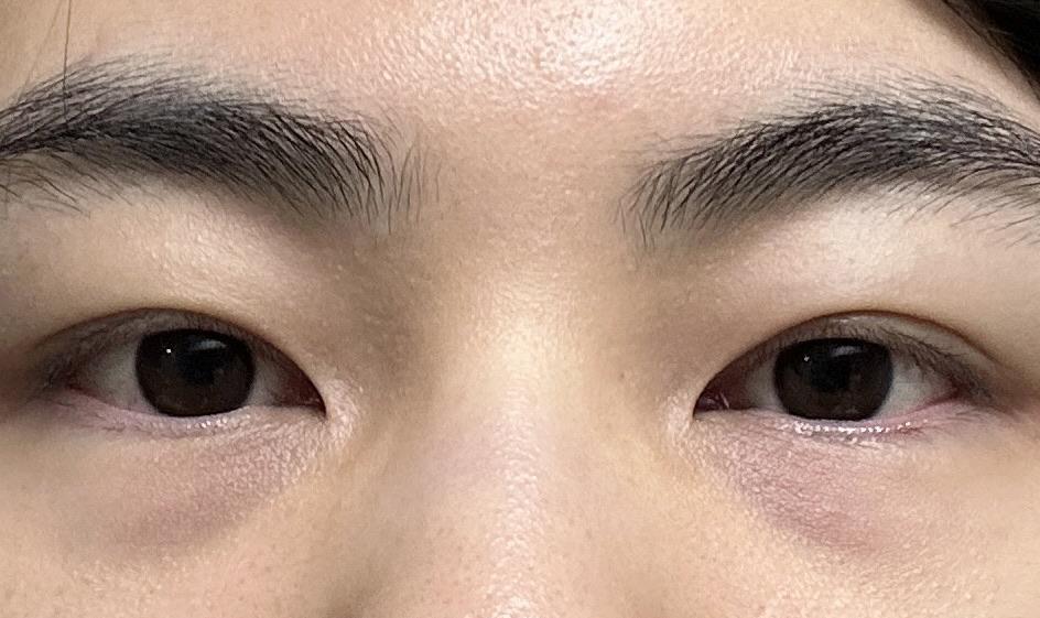 後