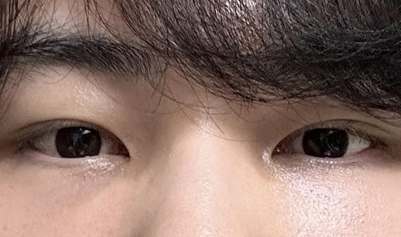 後