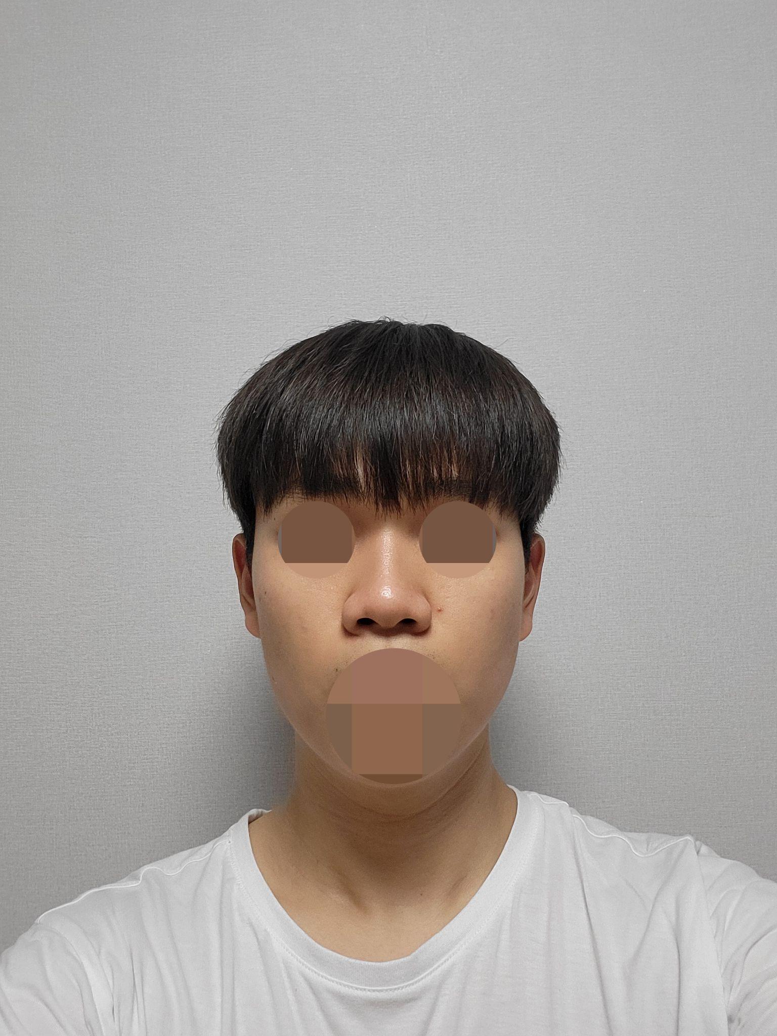 後