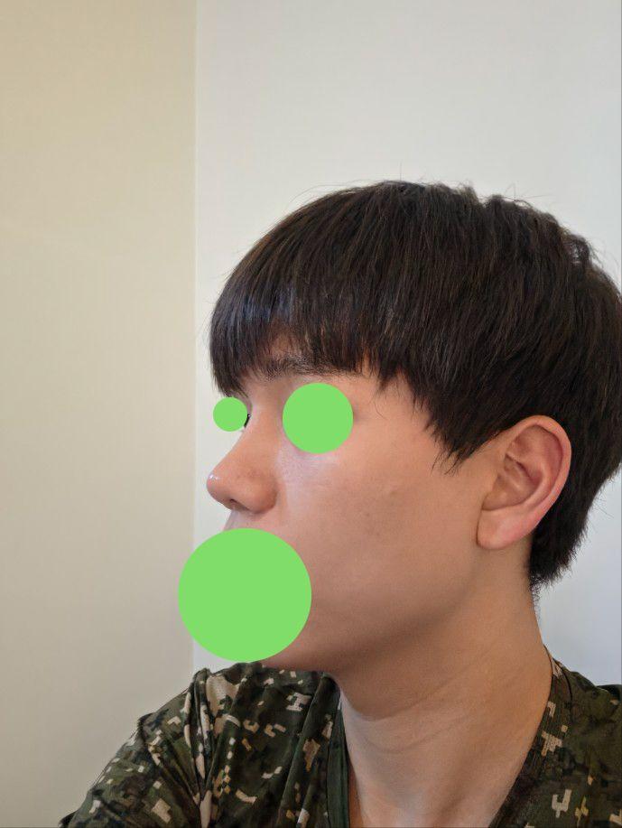 後