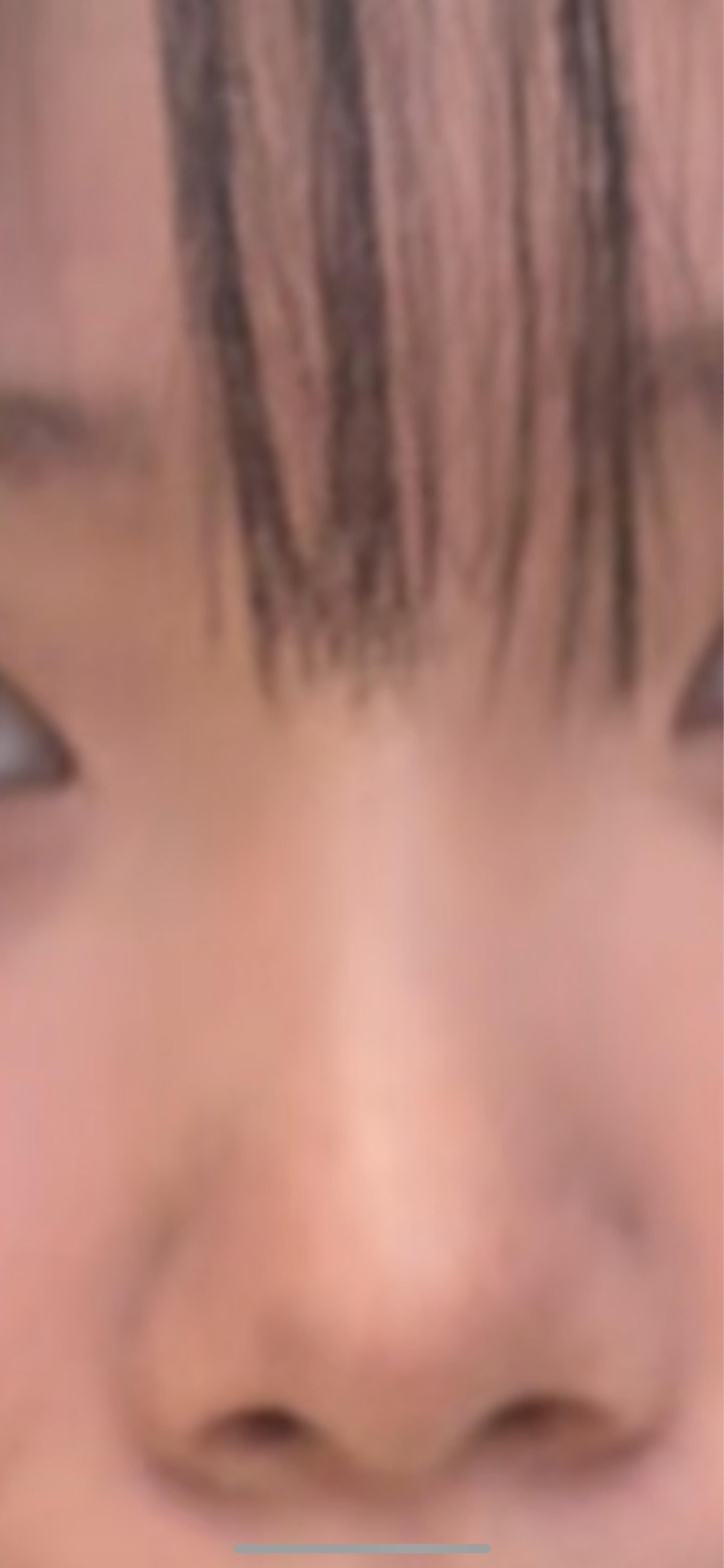 後