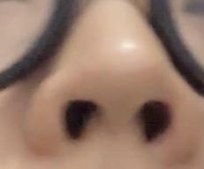 前