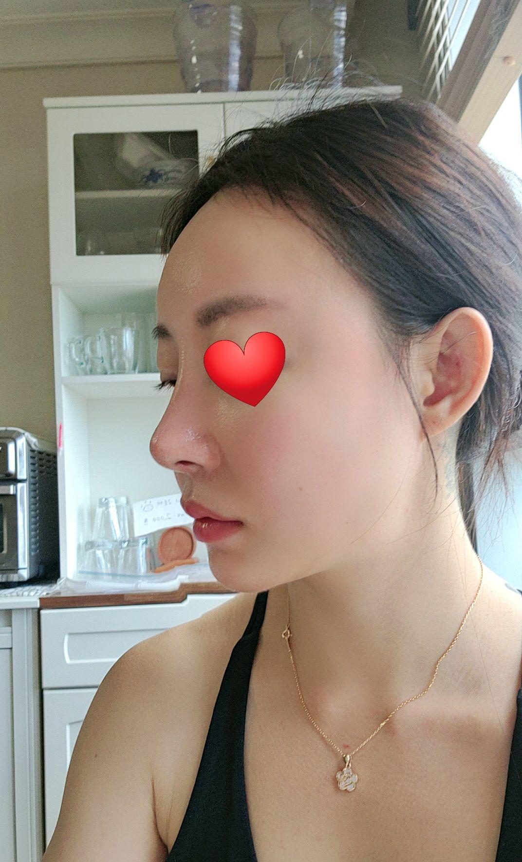 After