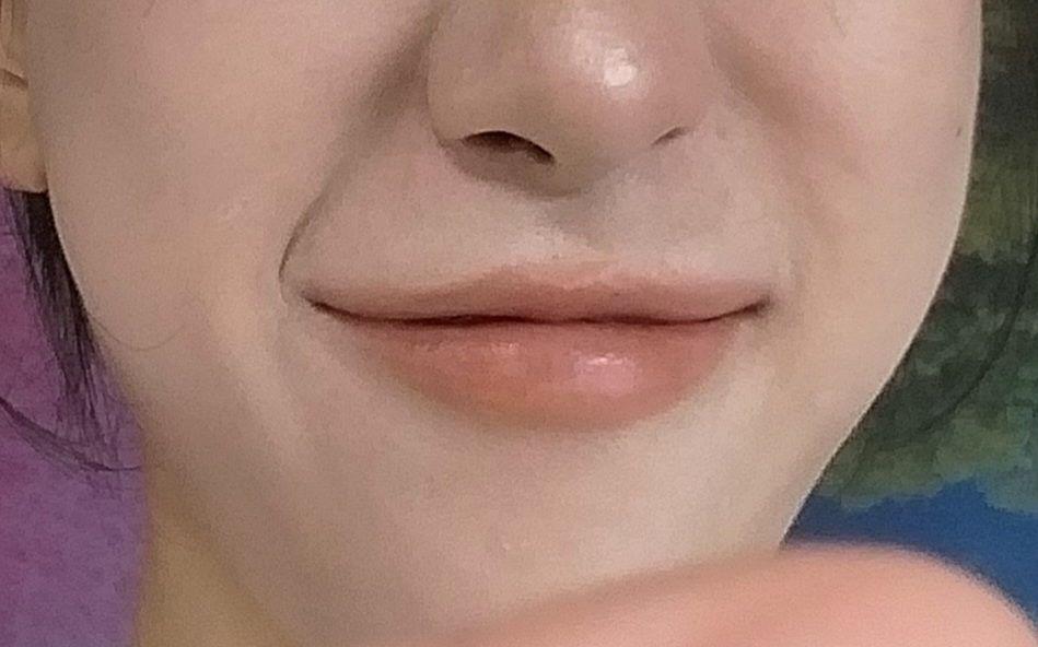 後