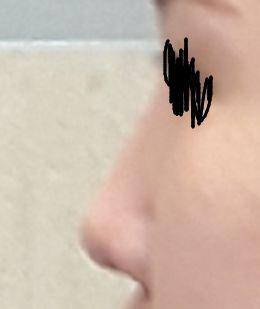 後