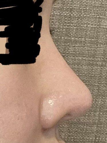 後