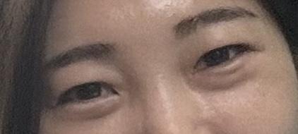 後