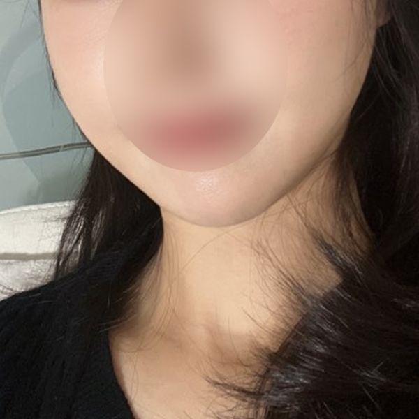 後