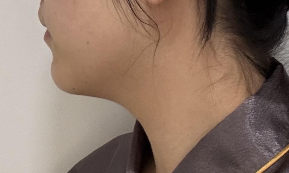 後