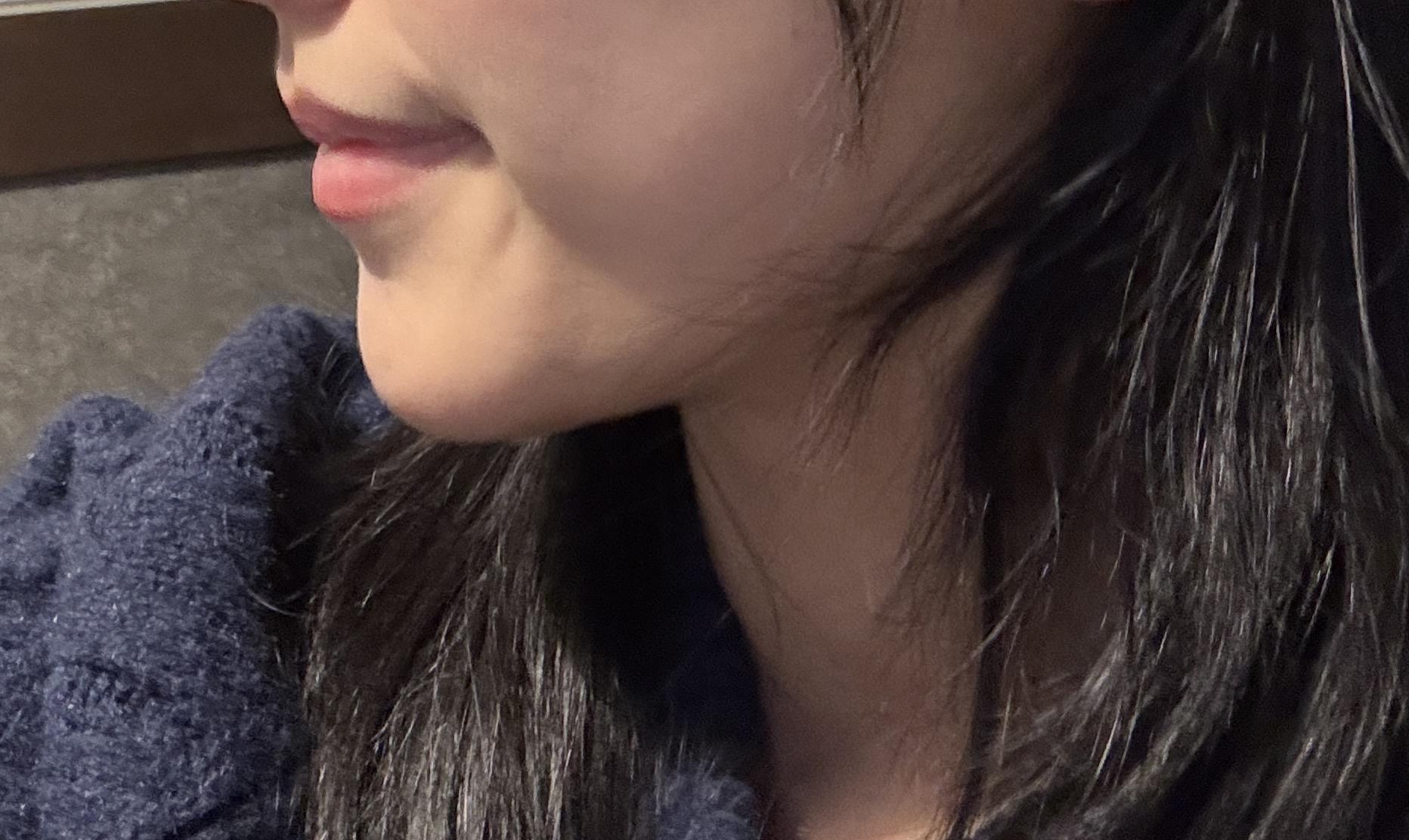 後
