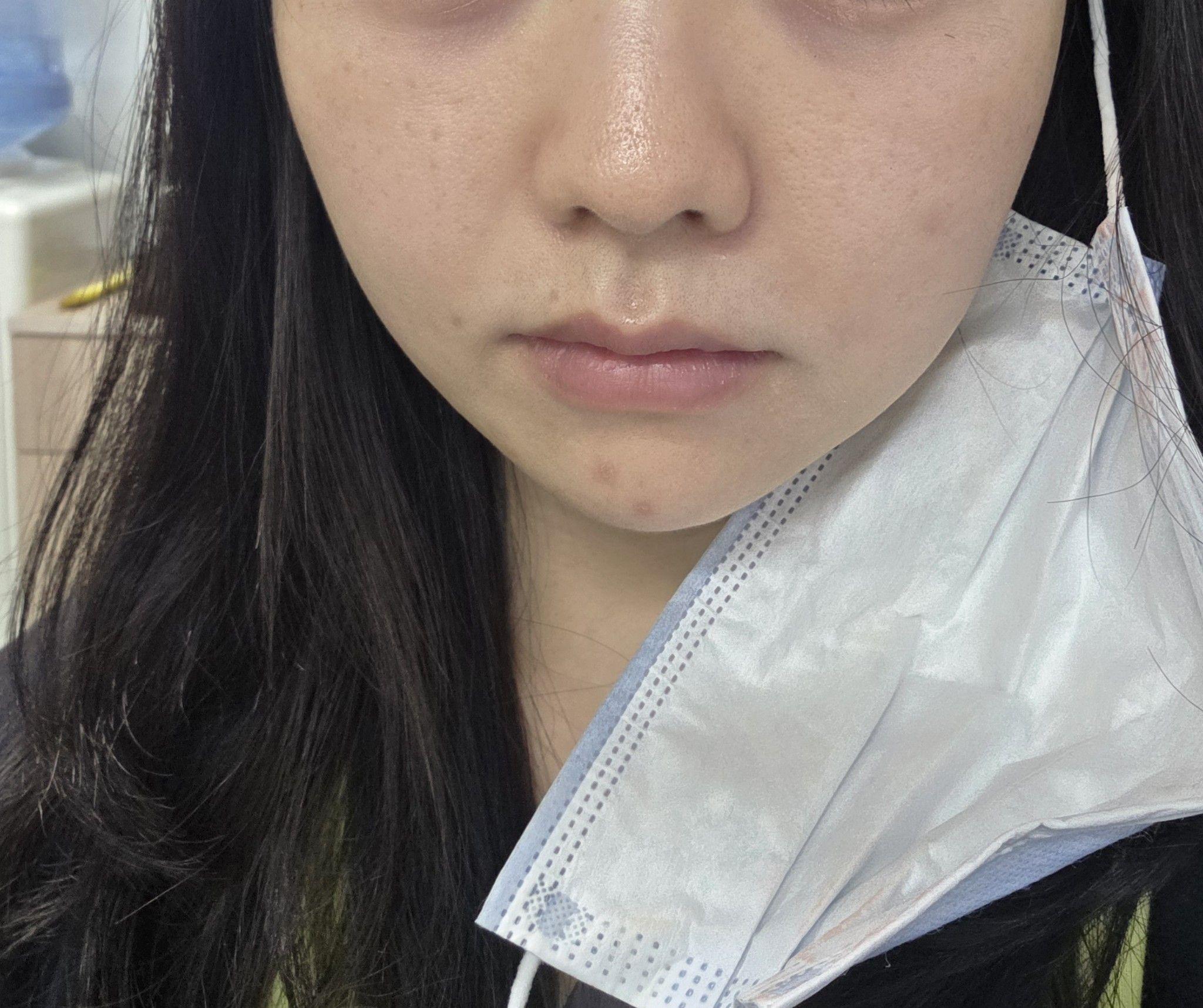 後