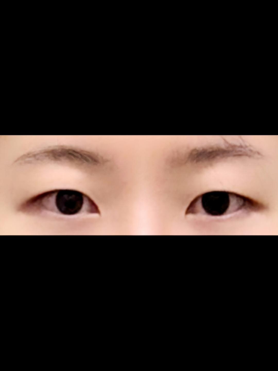 後