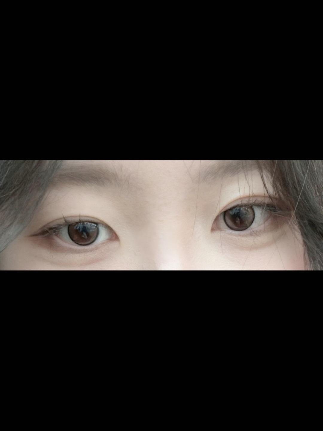 後