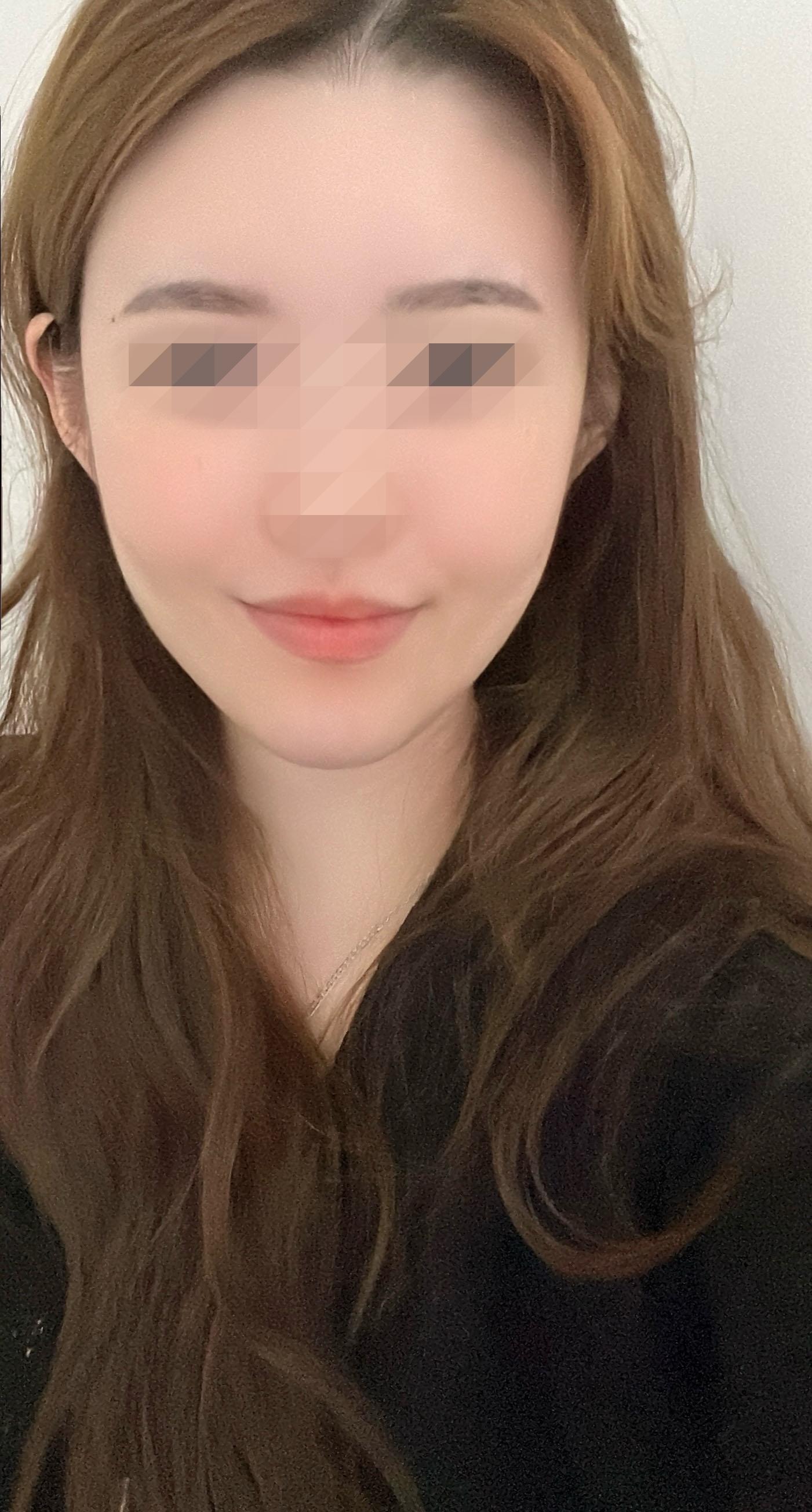 後