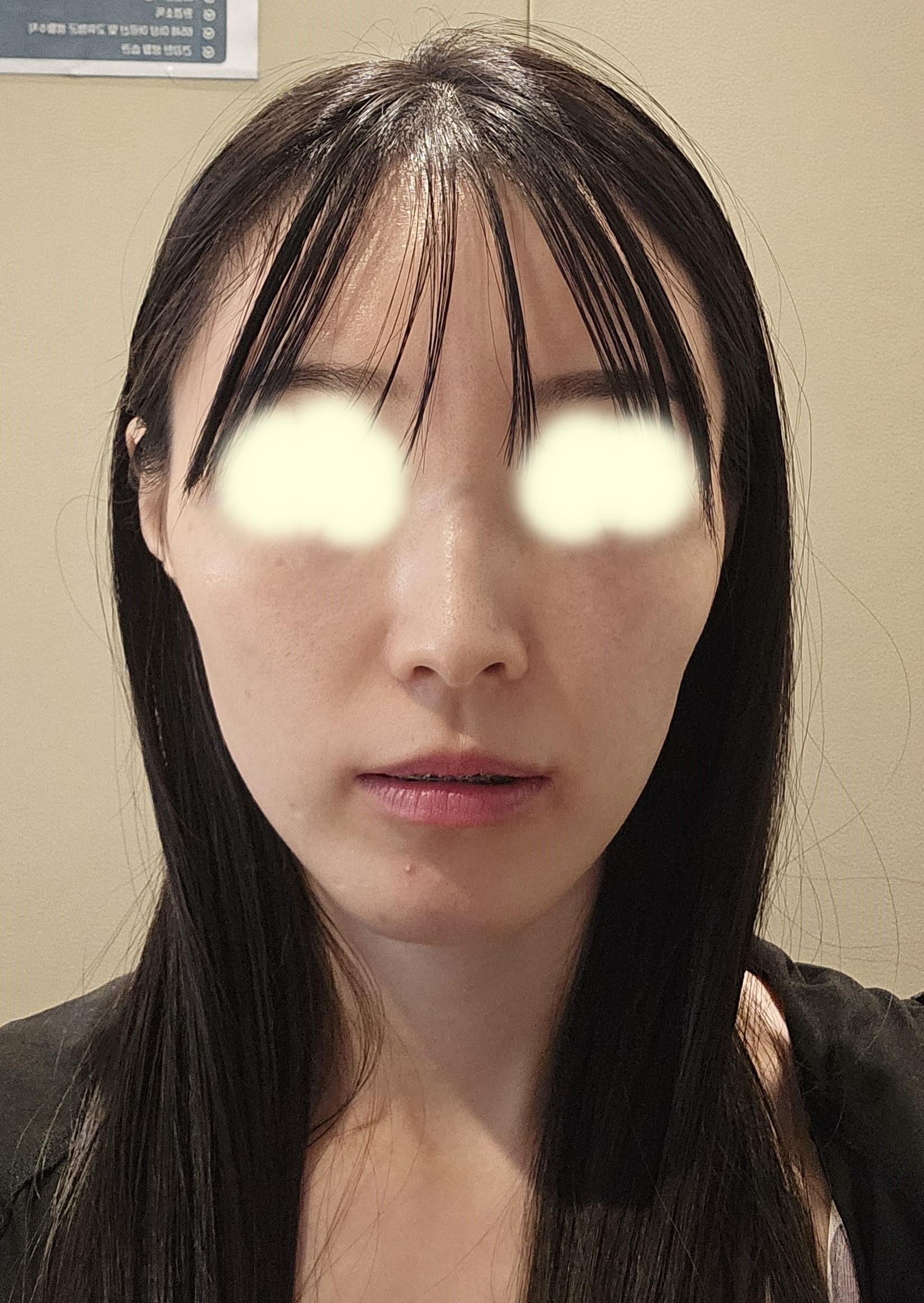 後