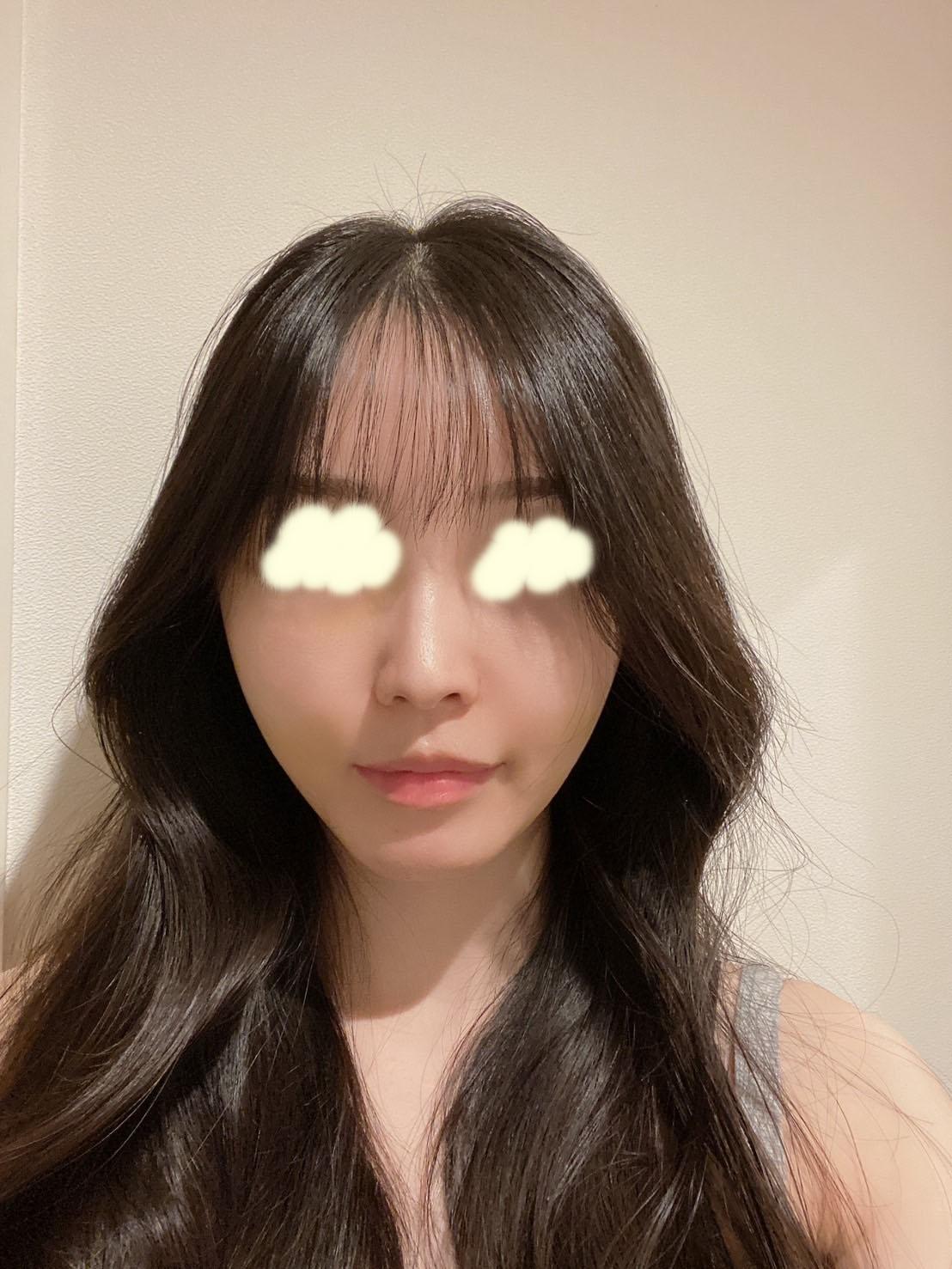 後