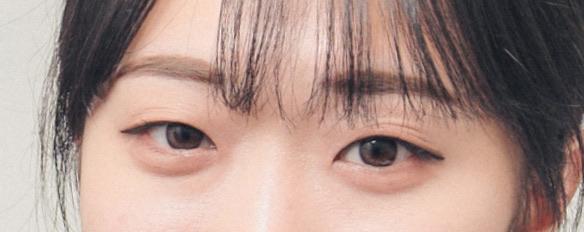 前