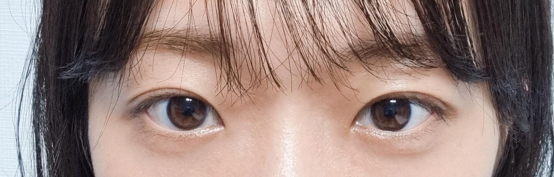 后