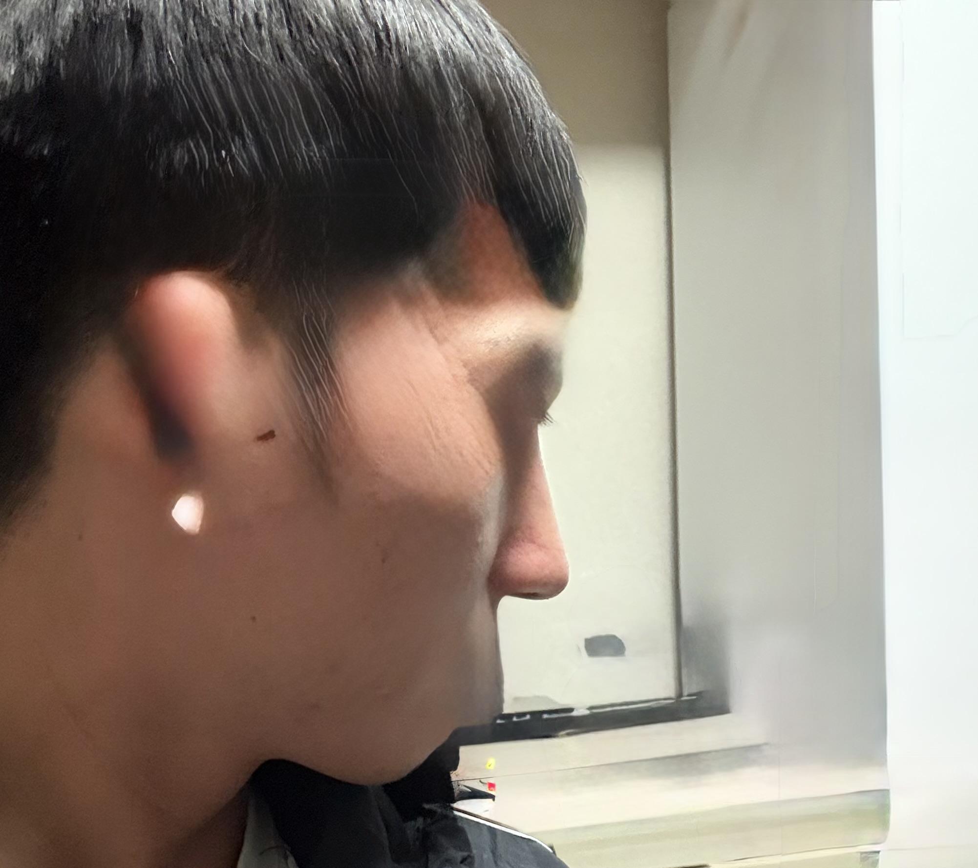 後