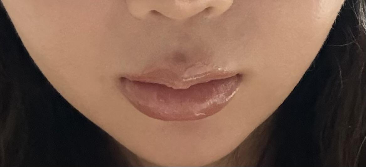 後