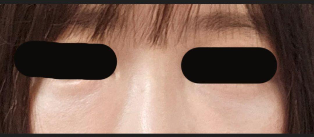 後