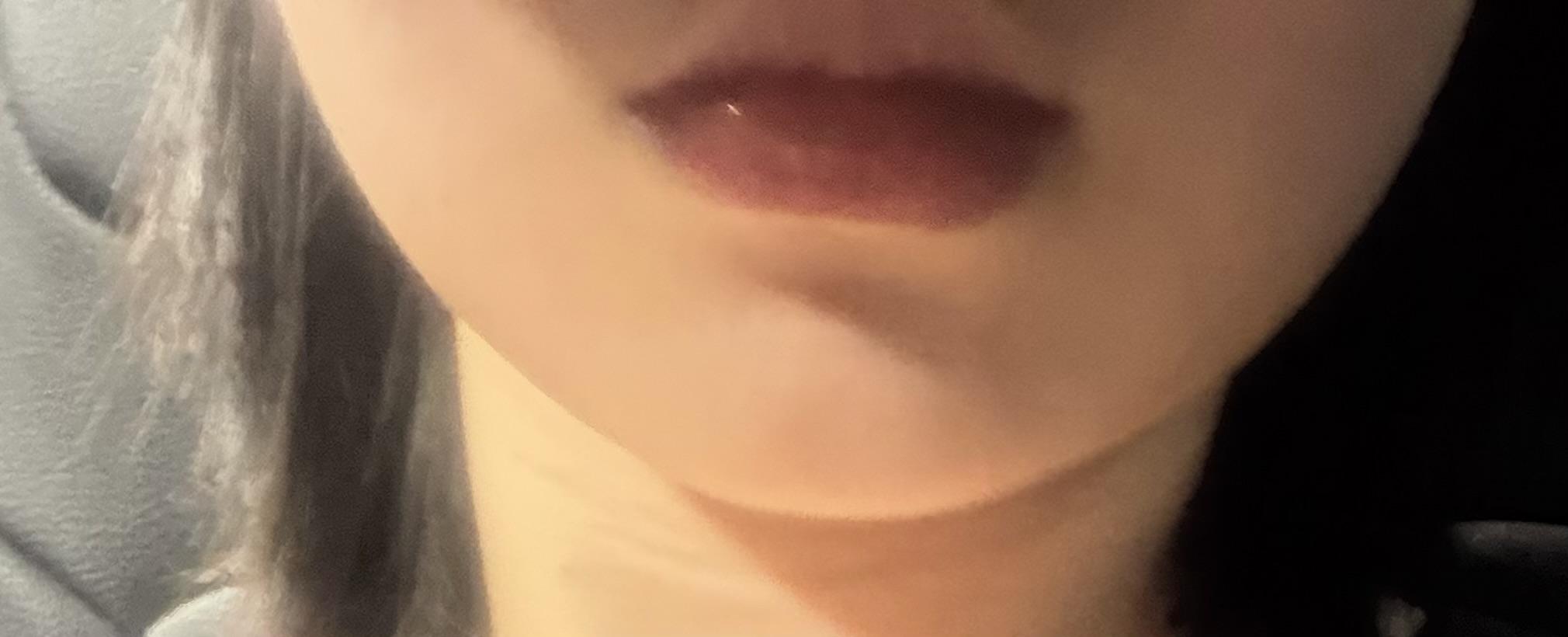 後