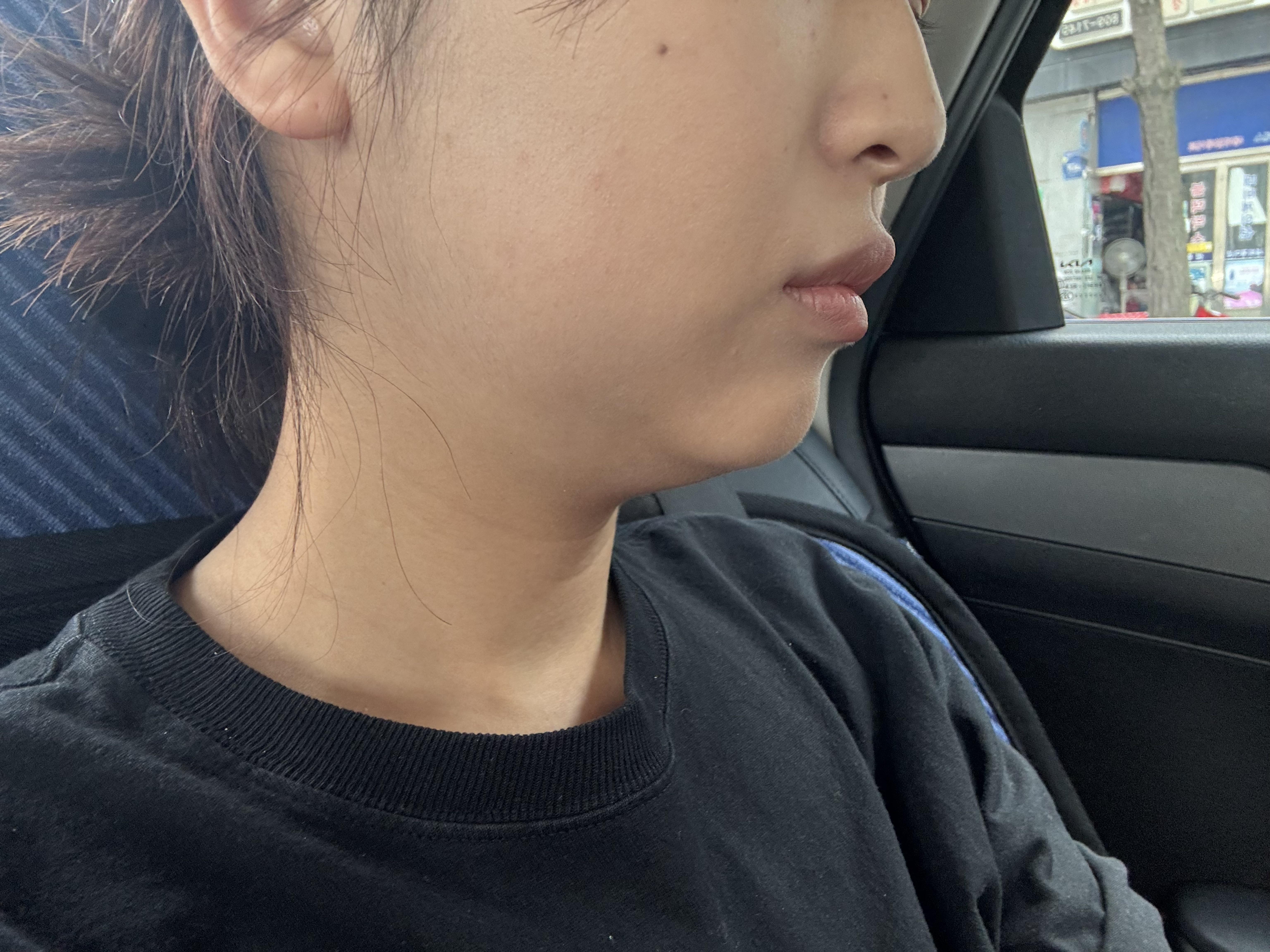 後