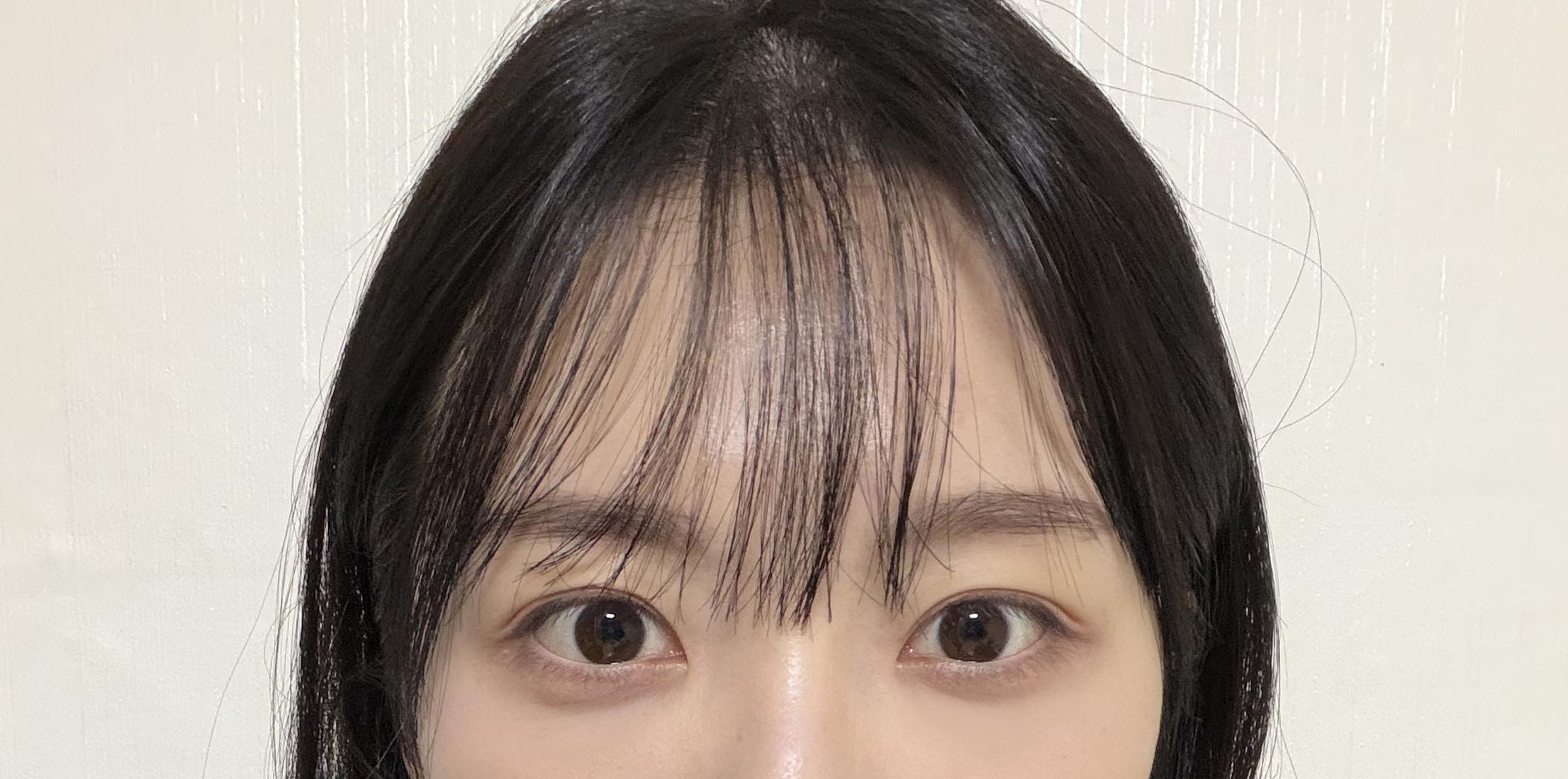 後