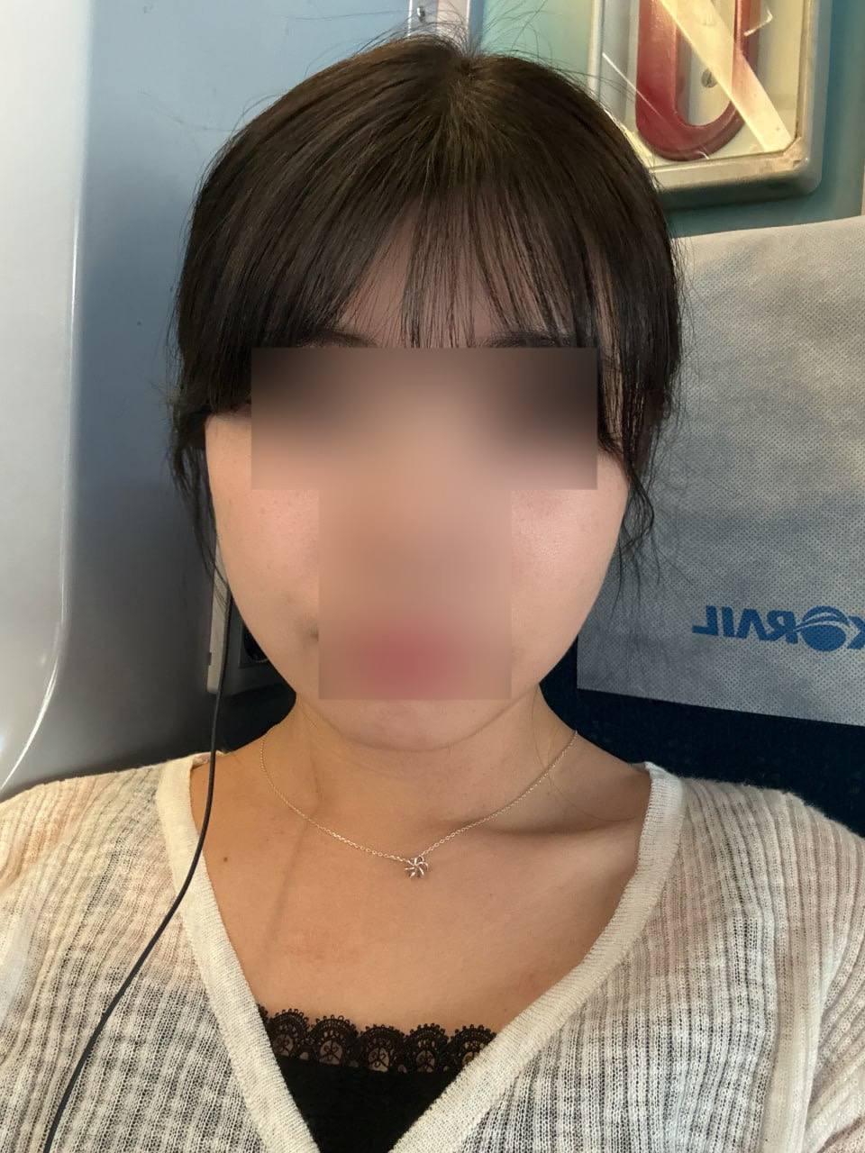 後