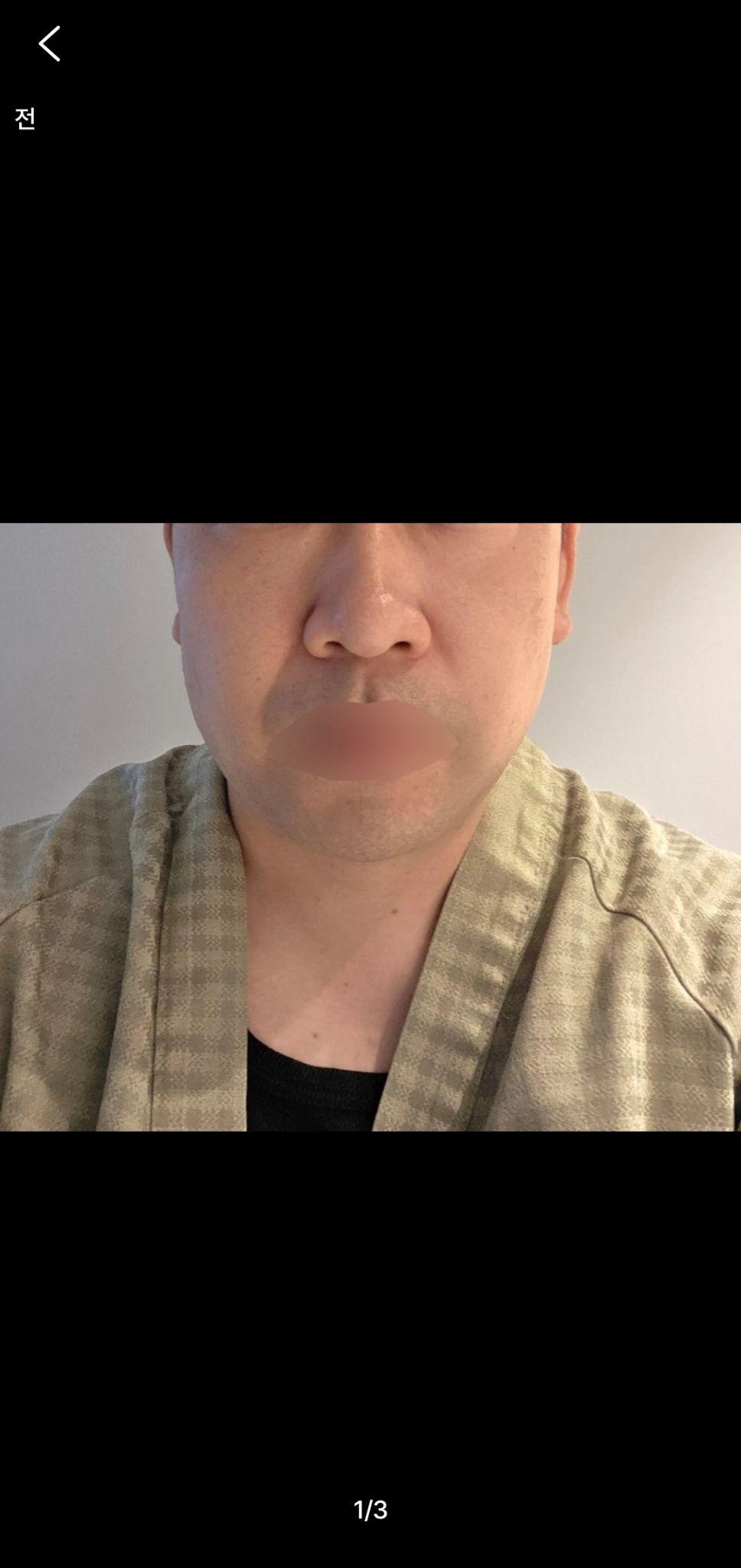 後