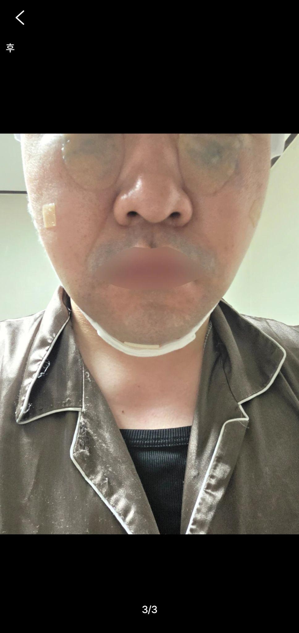後