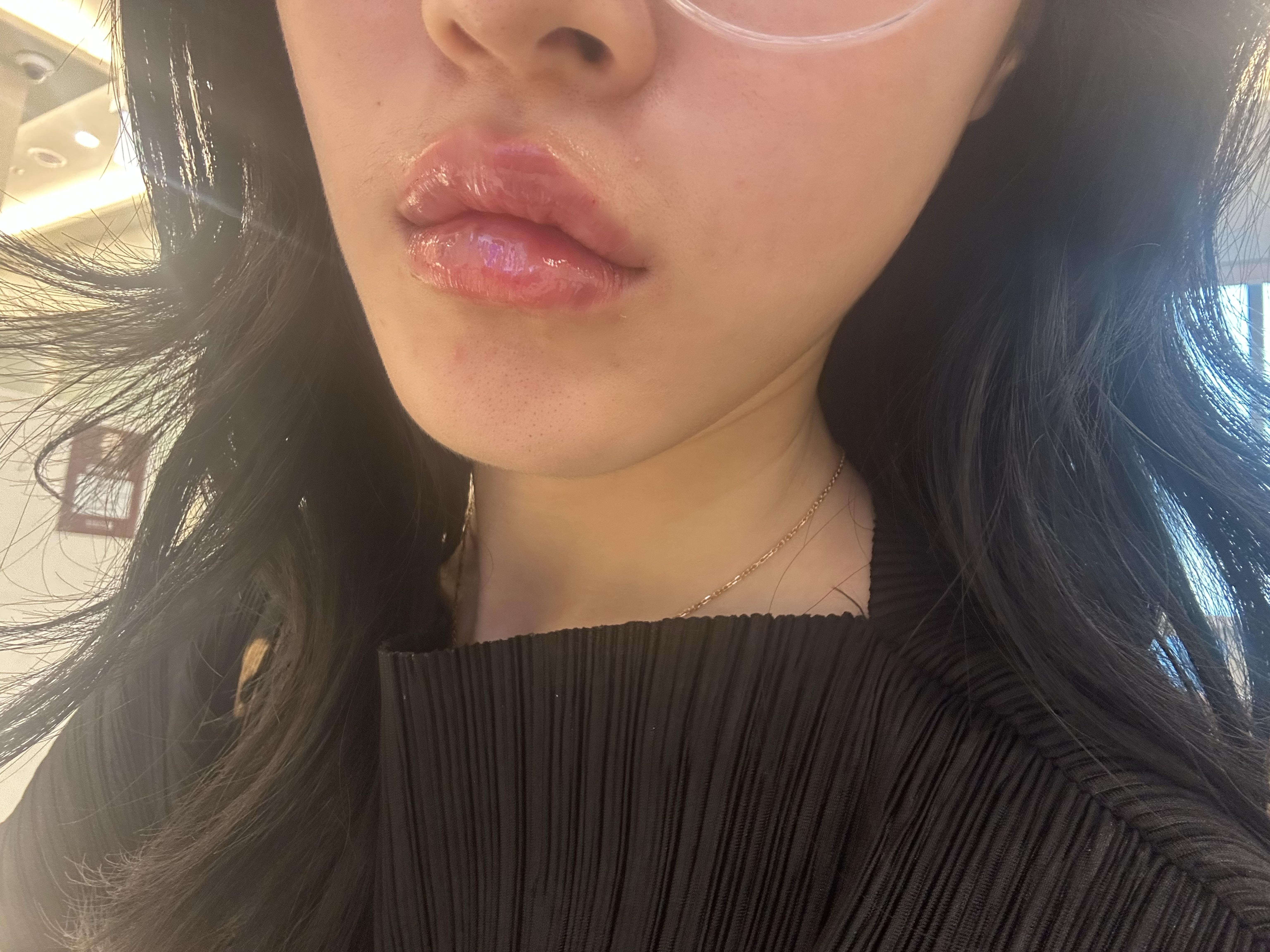 后