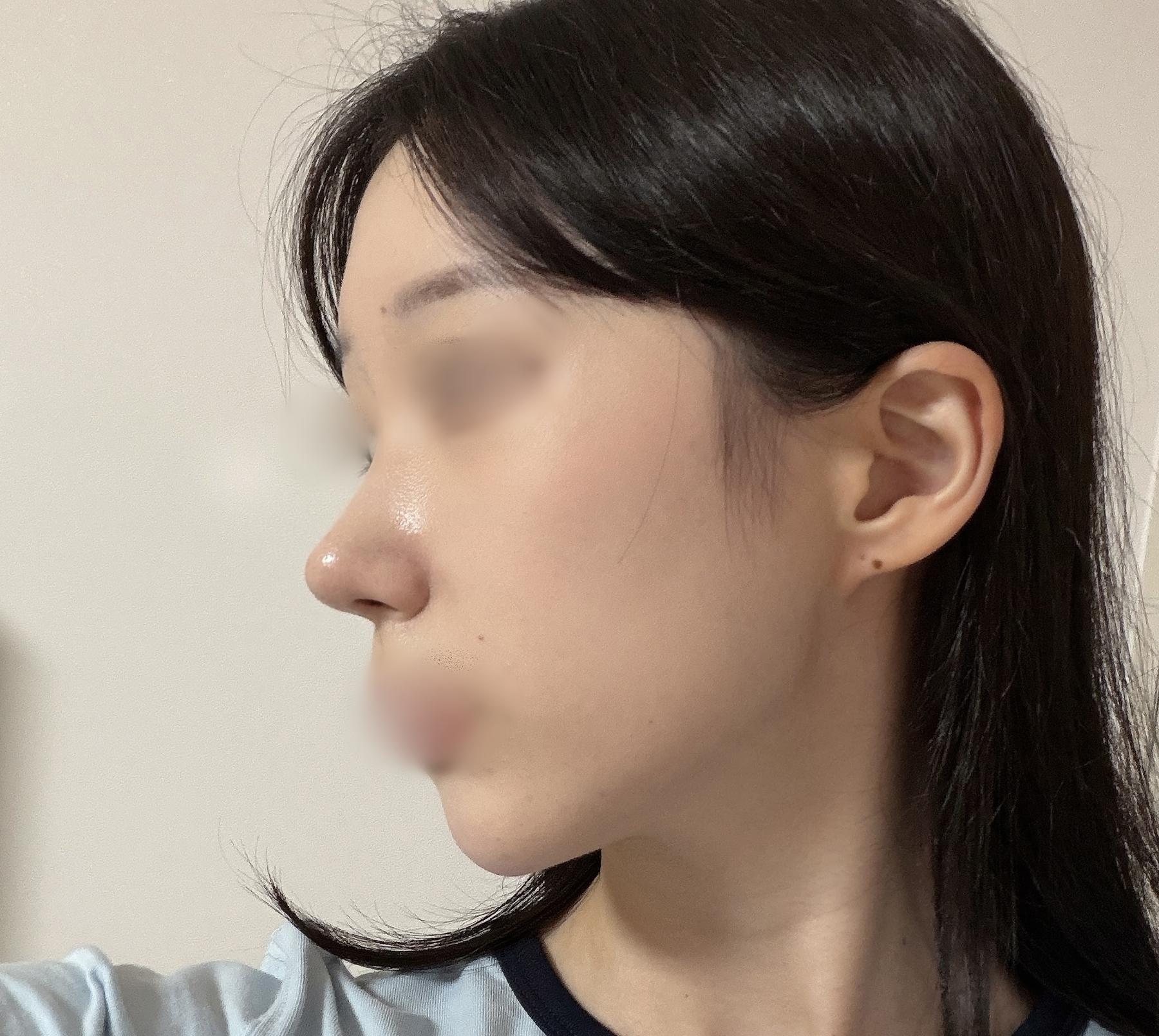 後