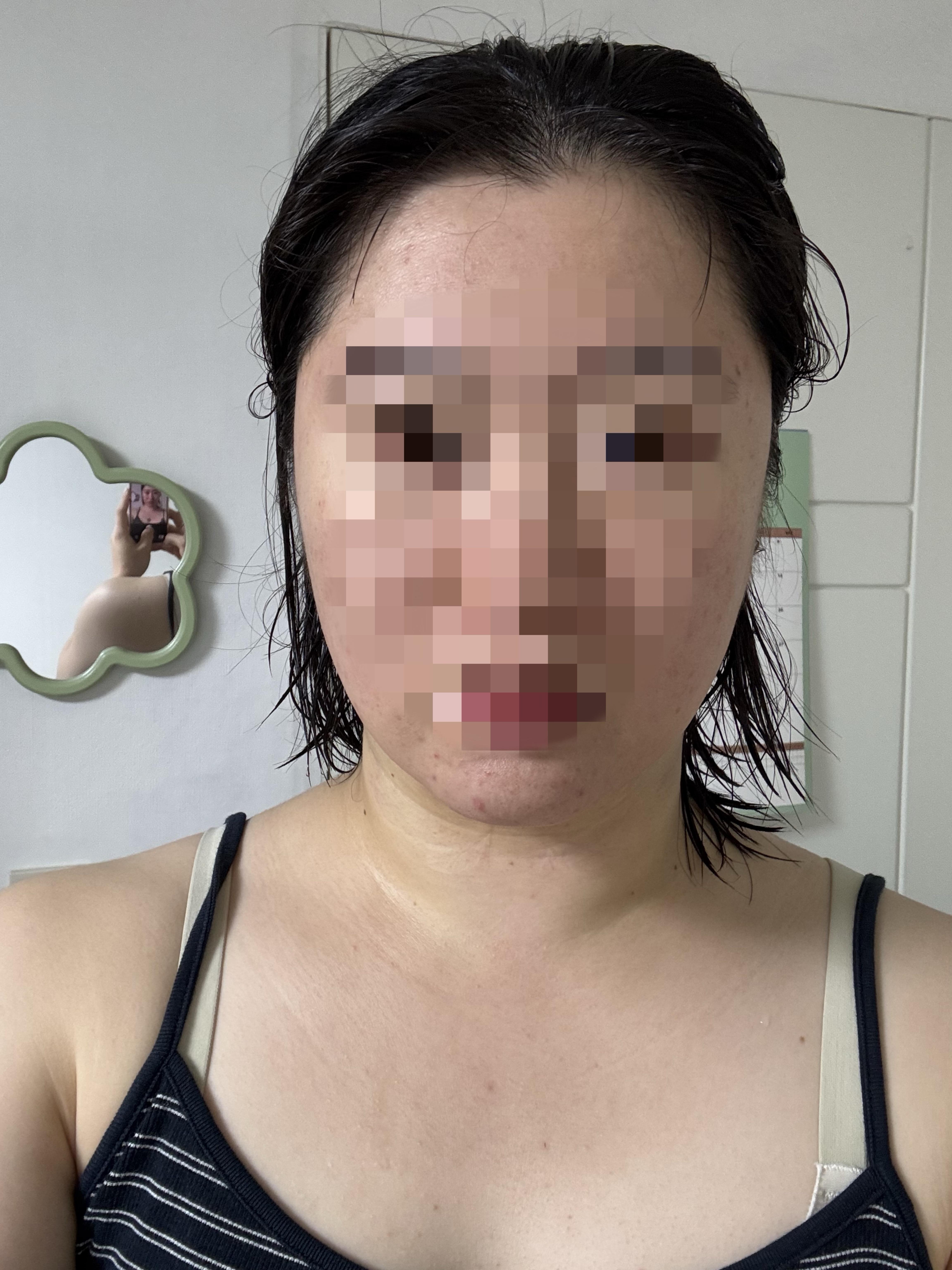 後