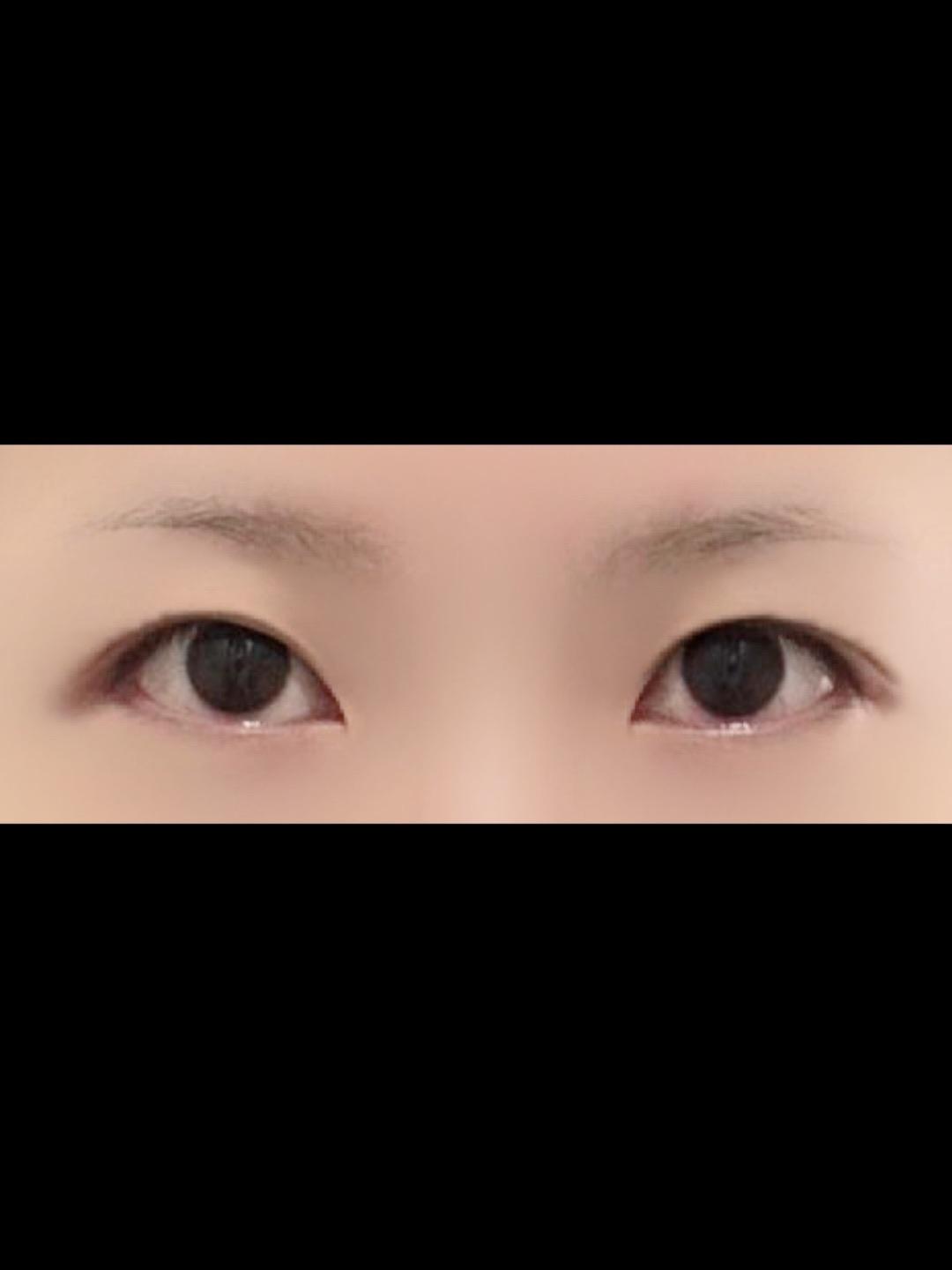 後