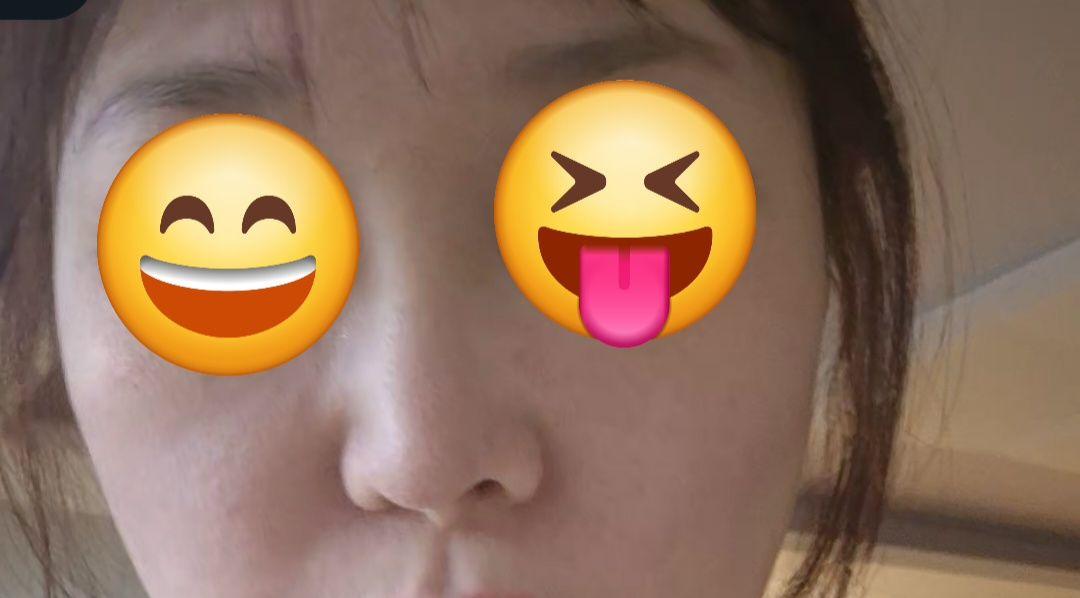 前