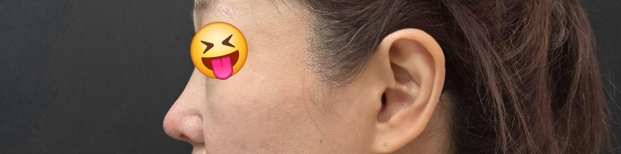 後