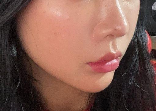 後