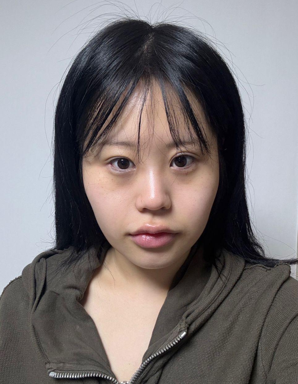 後