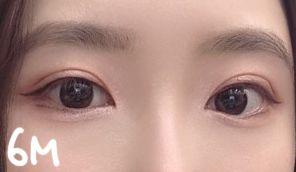後