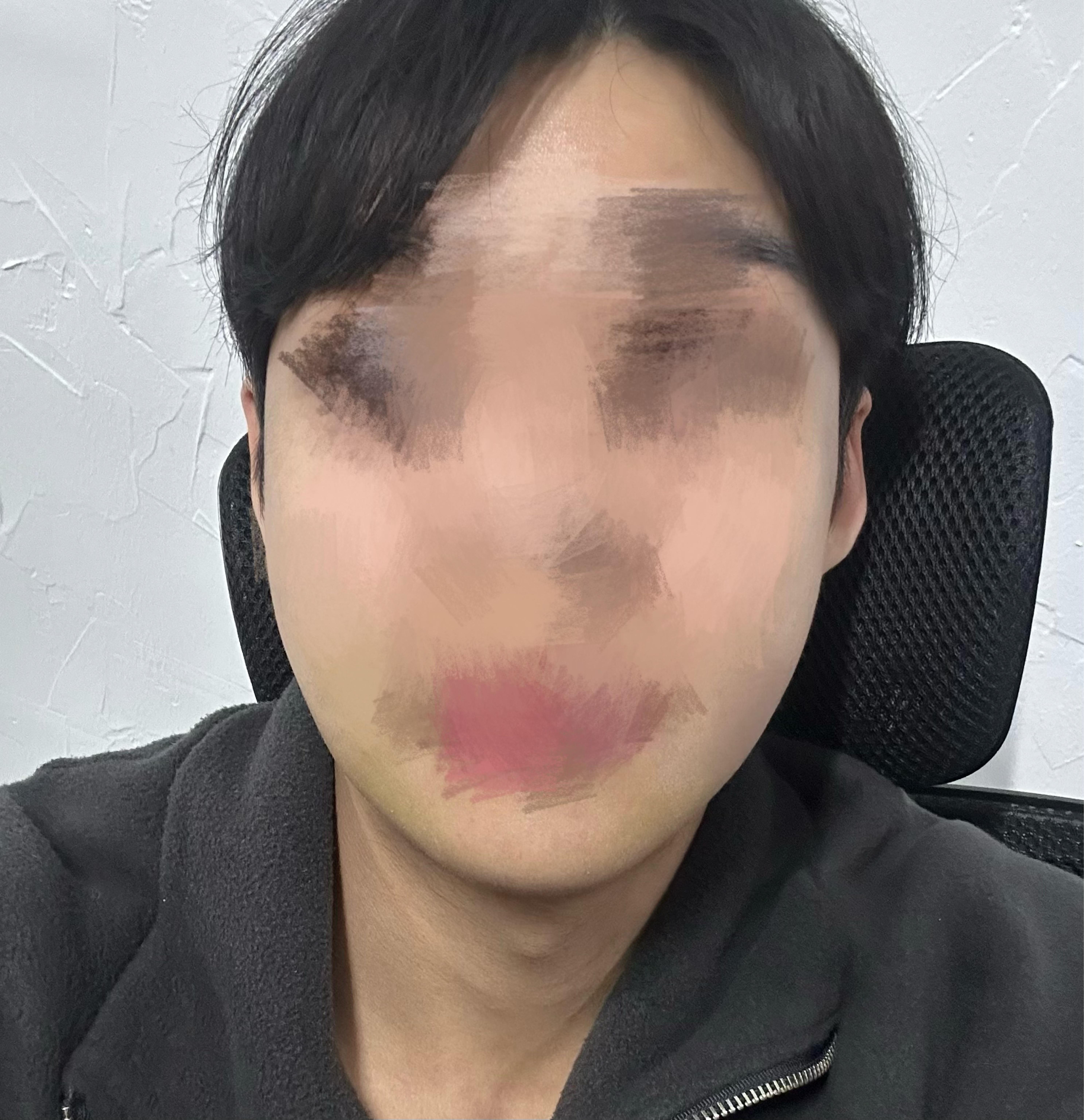 後