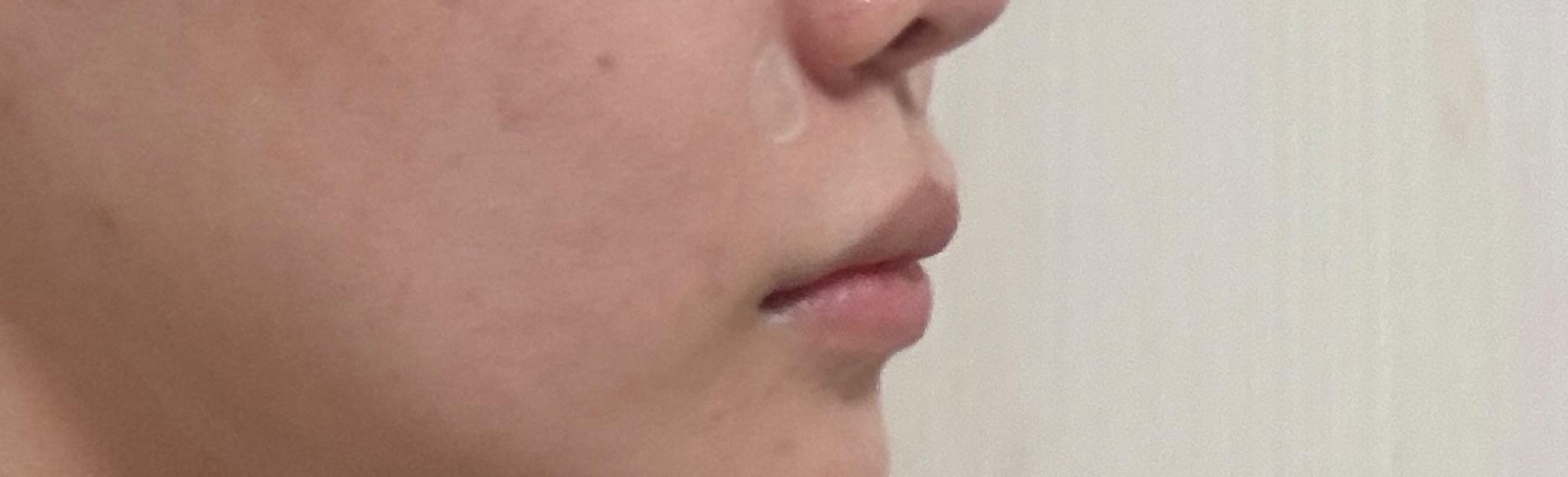 後